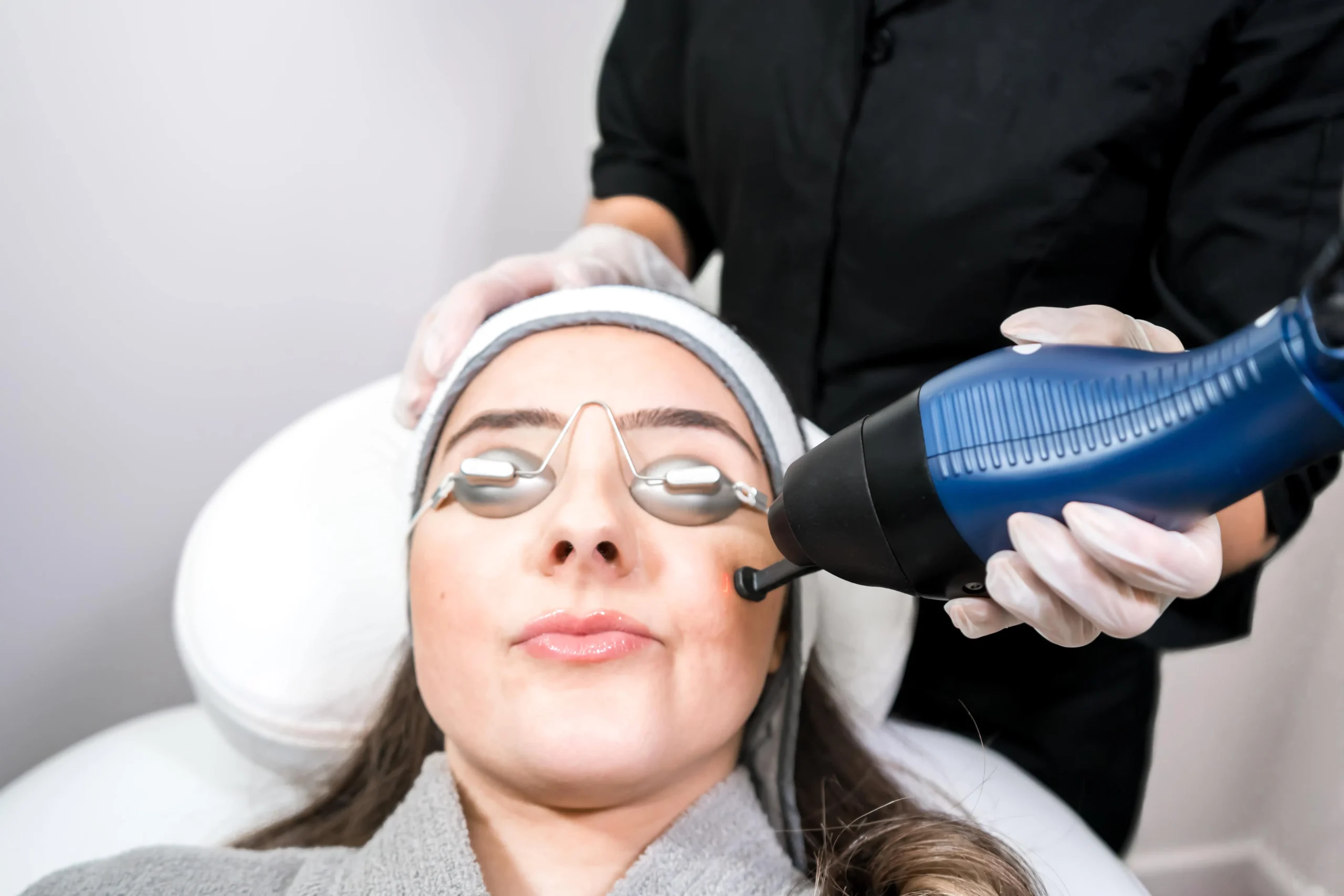 Woman wearing protective goggles receives laser skin treatment on face.